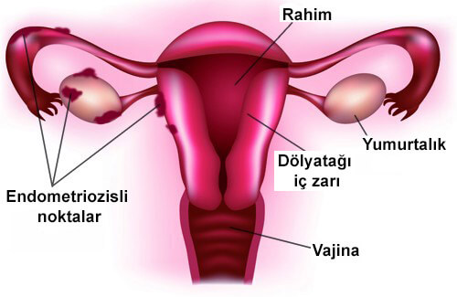Endometrium randevú-diagram